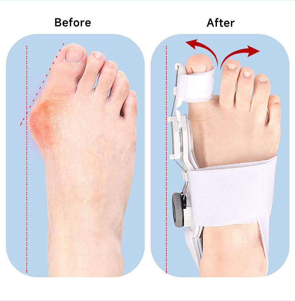 Toe Straightener Bunion Corrector Unisex Valgus Adjustable Toe Corrector Rotatable Separator Splint Braces for Left Right Foot