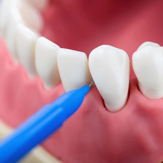 Yousheng 40Pcs/Box Interproximal Brush Safe Ergonomic Stainless Steel Wire Health Care Interdental Brush for Home