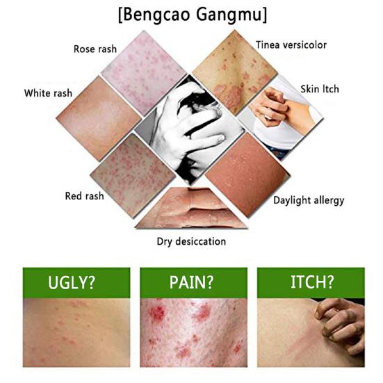 3 шт. крема эффективный без запаха легкий китайский травяной крем от экземы дерматита для ежедневного использования