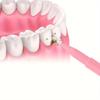 Межзубная щетка в виде карандаша Oral Interdental Brush I-образная прямая скоба межзубная щетка 30 шт./коробка