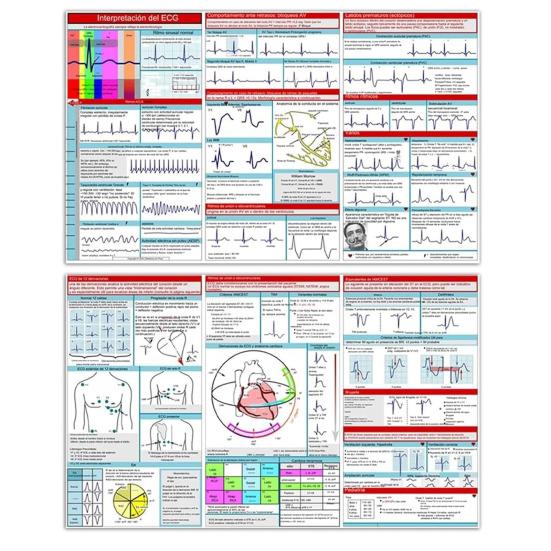 Карманный справочник ЭКГ Интерпретация ритма ЭКГ Двусторонняя карманная справочная карта Tri-Fold Study