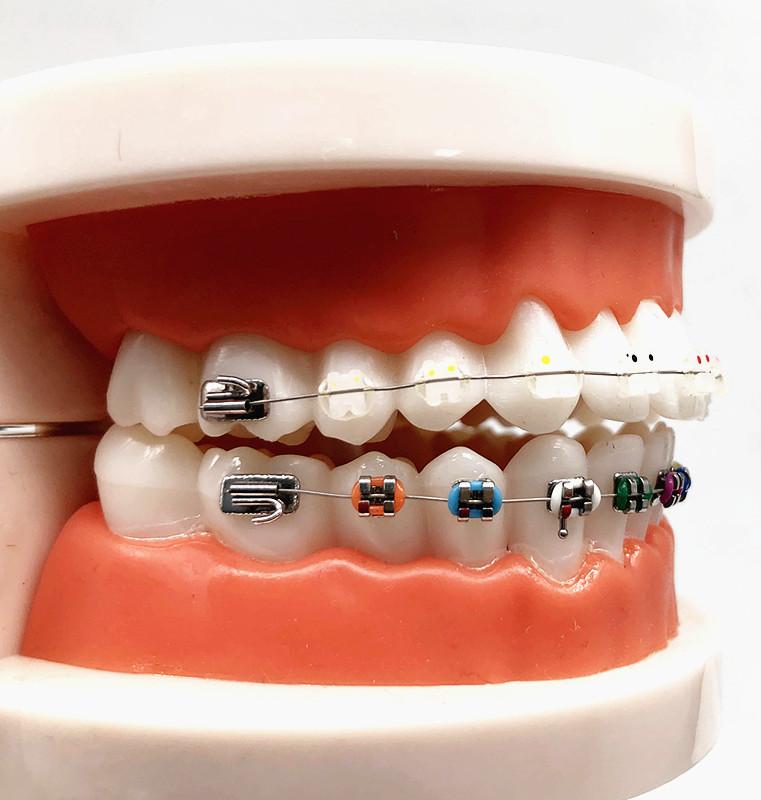 1 шт., стоматологическая модель для ухода за полостью рта, стоматологическая ортодонтическая модель для общения с пациентом, модель для исследования стоматолога