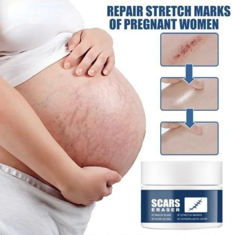 Не раздражающий восстанавливающий синтетический крем для удаления шрамов