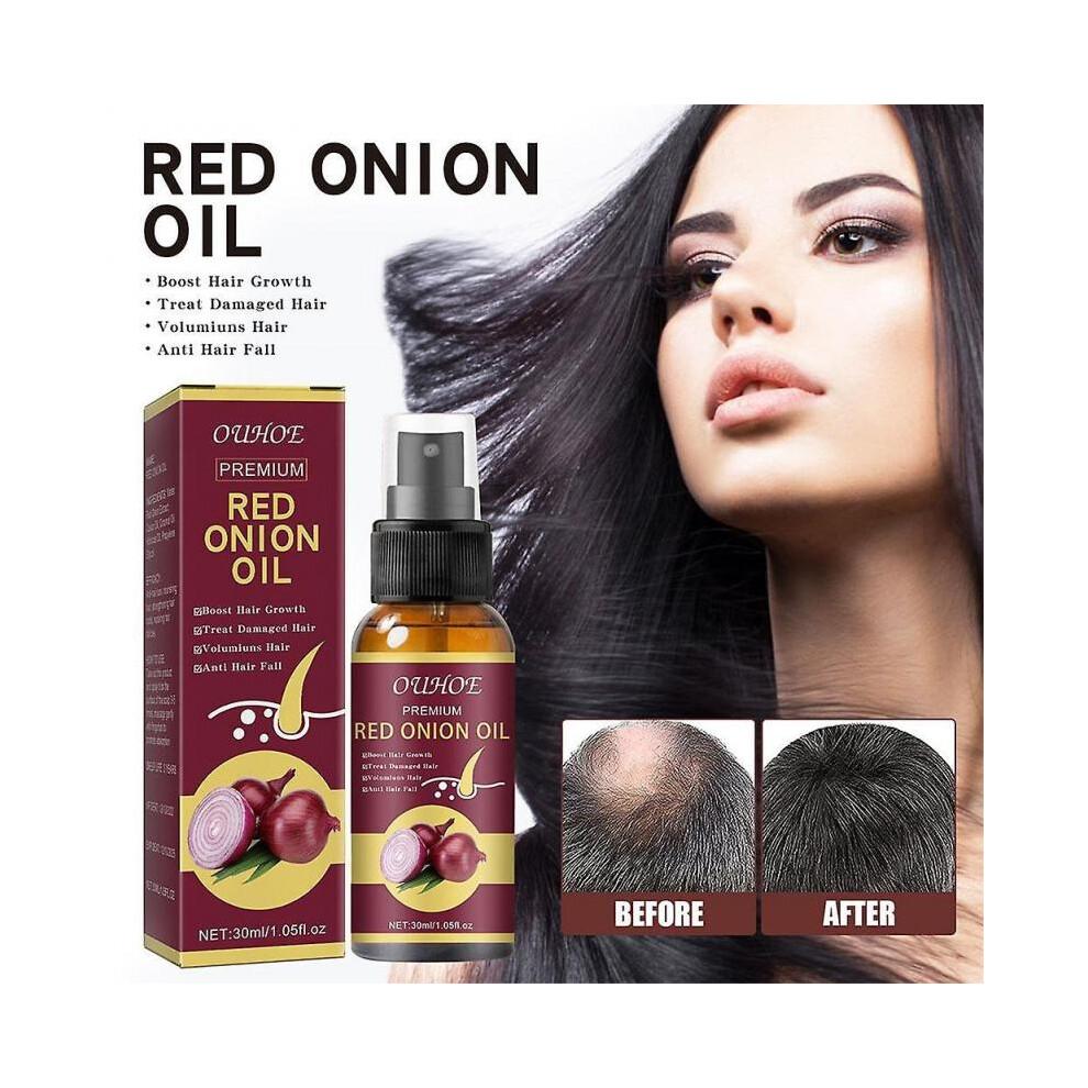 Onion Hair Growth Oil 30ml, Anti-Hair Loss Nourishing Essential Oil for Stronger Roots and Healthy Scalp