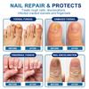 Крем для лечения ногтей, улучшает твердость ногтей, осветляет цвет ногтей