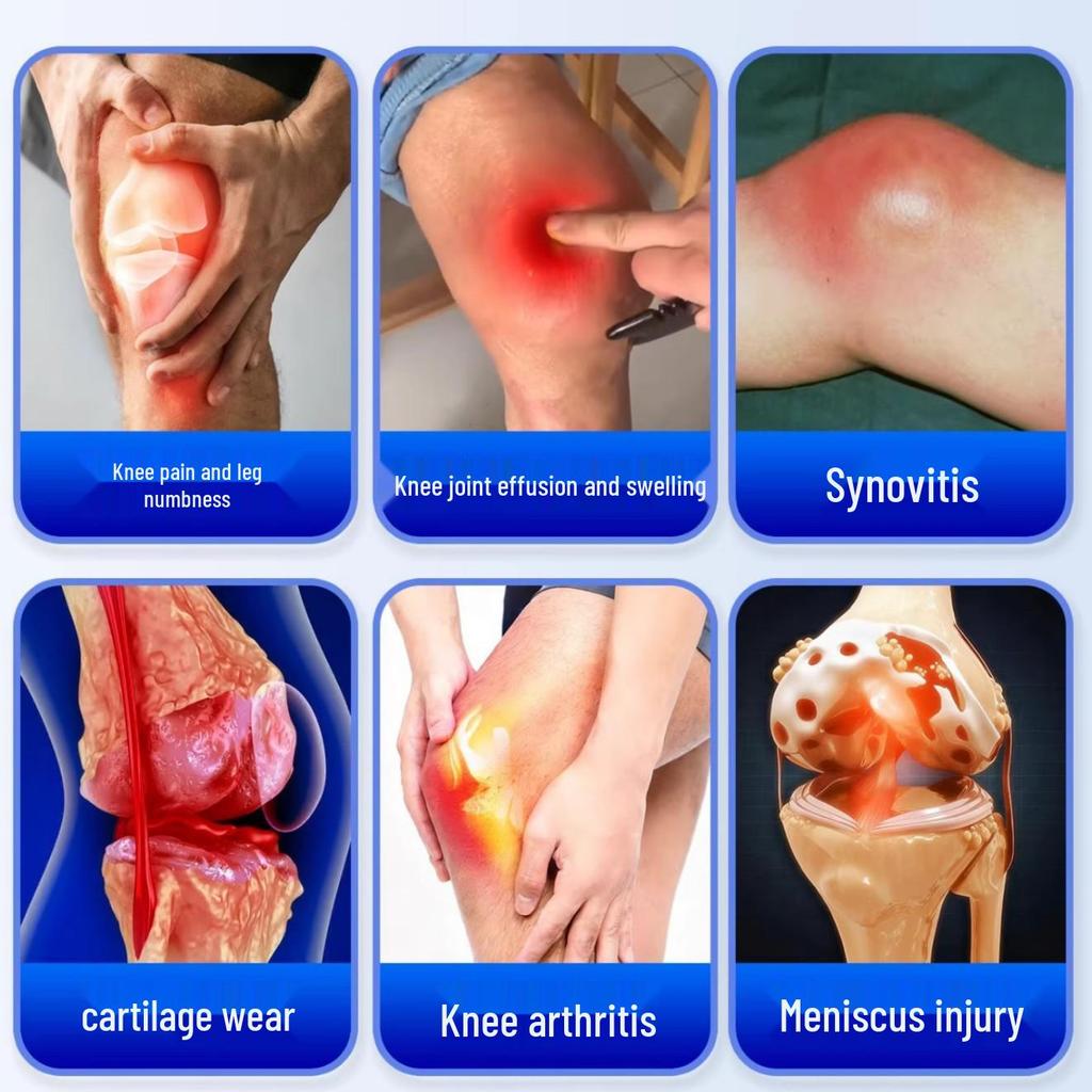 Улучшенная наколенка: Даль-инфракрасная мазь для мениска и суставных сухожилий для облегчения синовита.