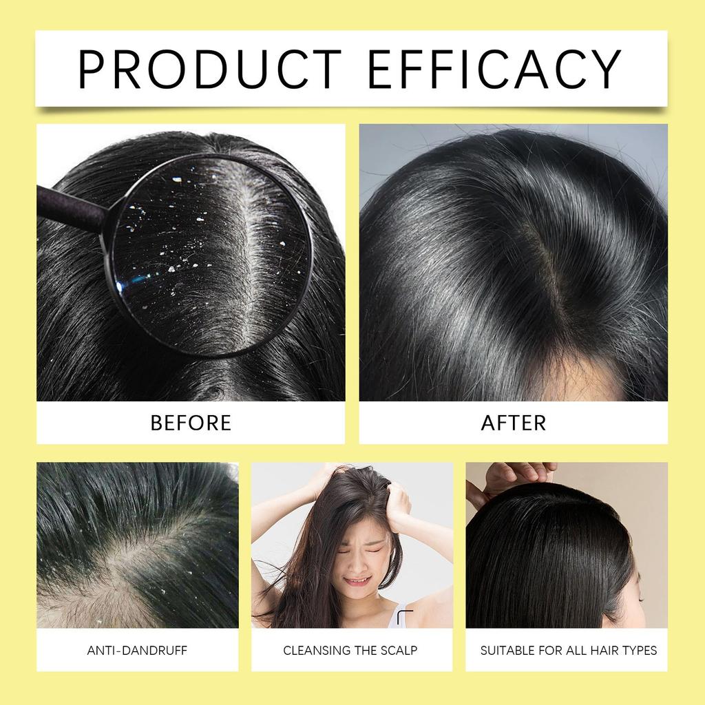 Шампунь против перхоти Sulphur Oil Control мягко очищает волосы и улучшает состояние сухих и вьющихся волос