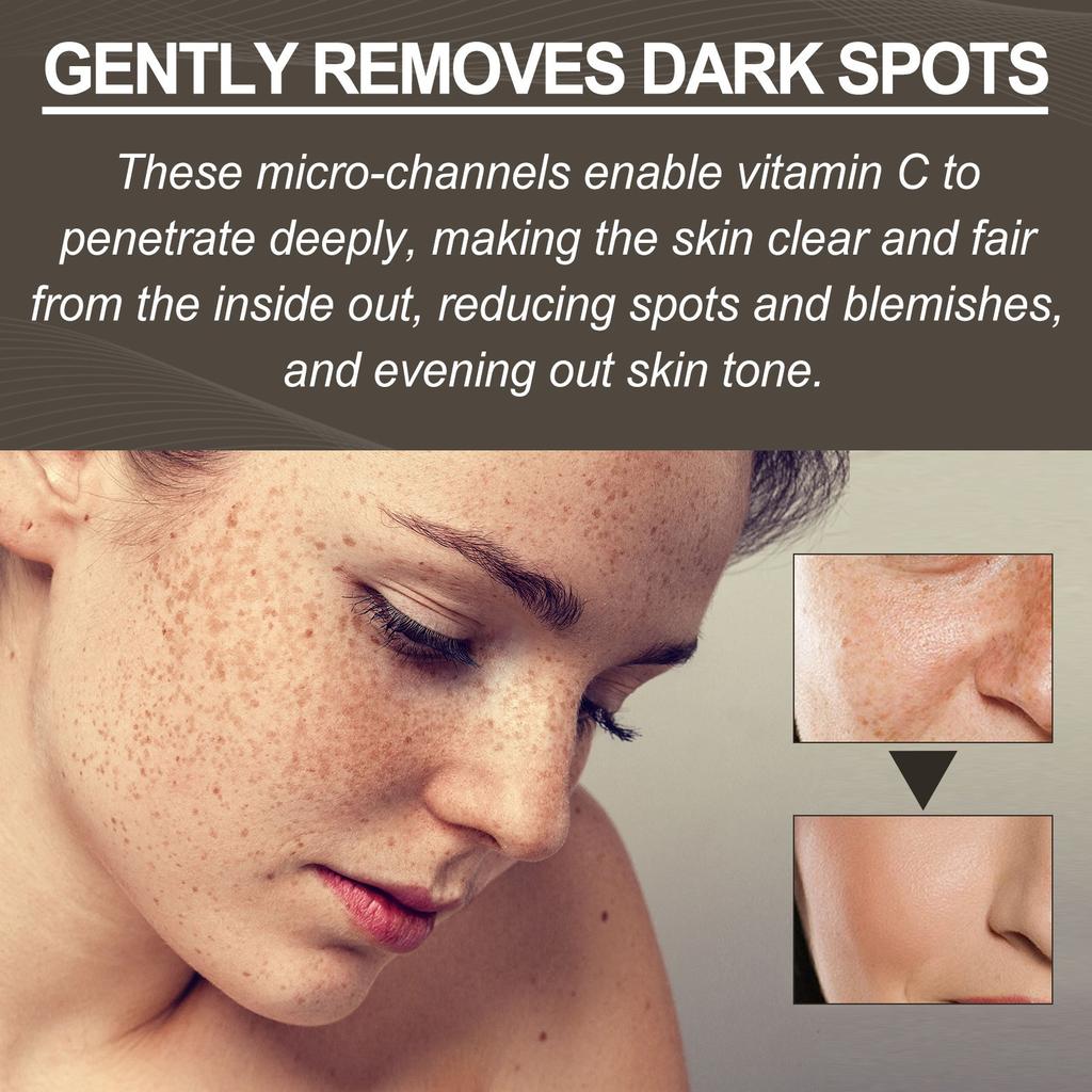 Патчи для лица от прыщей, микроиглы, сушильные патчи, закрывающие наклейки, 72 шт., уход, впитываются весь день