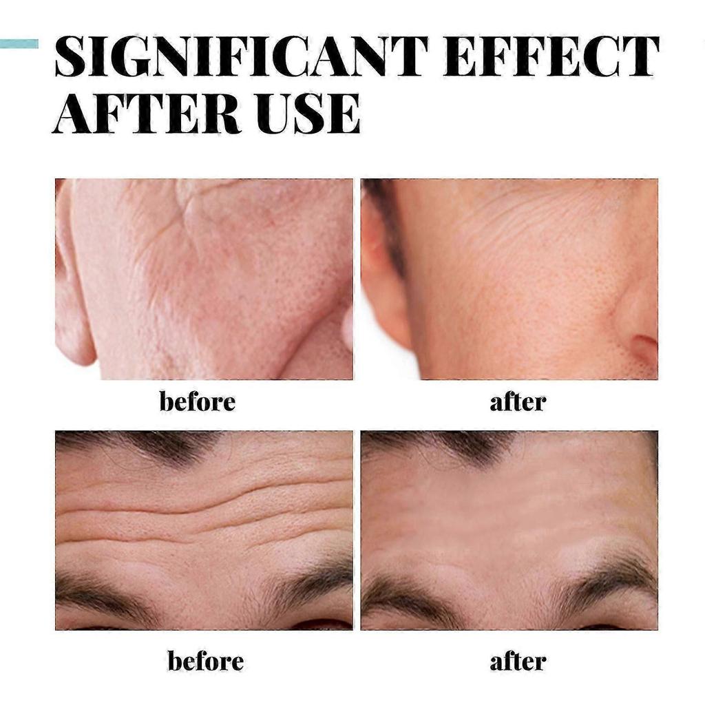 1PC Collagen Men's Anti-Aging Wrinkle Cream, 50g Face Moisturizer Age Rewind Anti Aging Cream for Men, Skin Firming and Tightening Lotion"--ZZ1