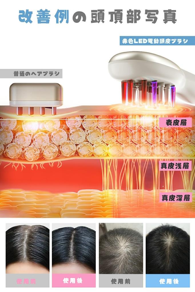 Электрический скальп Электрический косметический уход за кожей лица EMS скальп Множественный RF микро светодиодный свет Оптический уход за кожей лица и головы Большая емкость Жидкий Введение Расческа Дневной унисекс