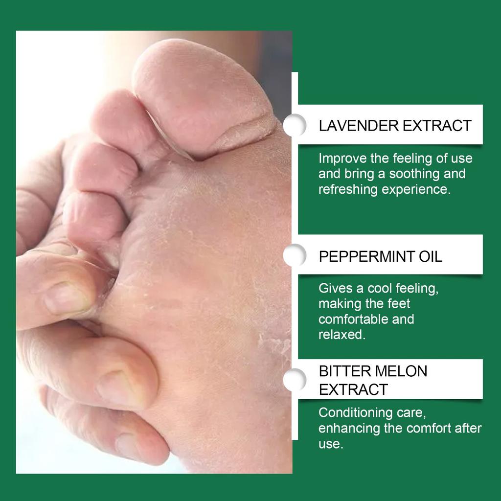 Athlete's Foot, натуральный травяной дезодорант-спрей для ног, подходит для большинства дезодорантов для ног, лечит зуд и запах(30мл