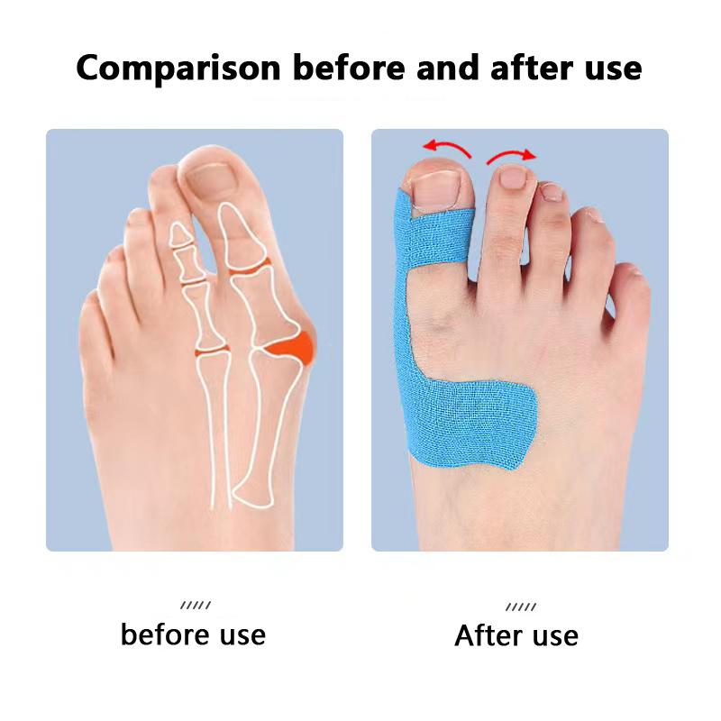 10pcs Hallux Valgus Fixed Support Athletic Elastic Bandage Toe Anti-Friction Safety Tape Patch Unisex Foot Care Tools