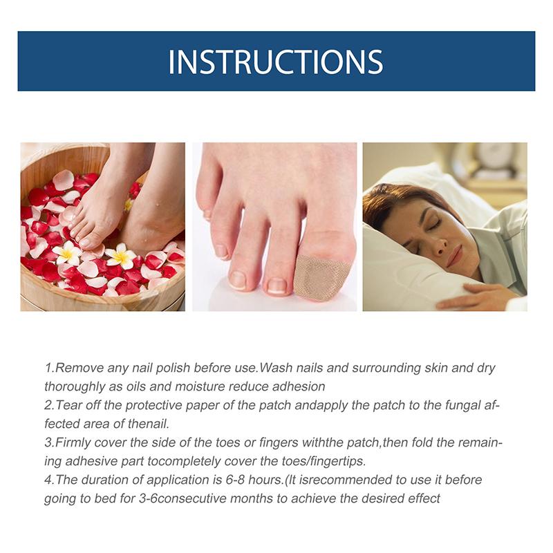 32 шт. безопасный пластырь для коррекции ногтей на ногах, наклейка для выпрямления ногтей