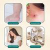 Mosquito Bite Soothing Ointment for 0-3Y Infants – Thai Dingding