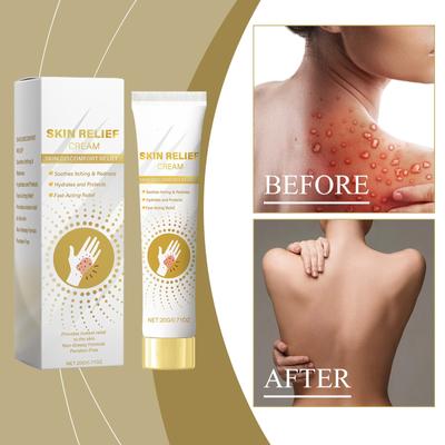 Успокаивающий крем для кожи быстро снимает симптомы экземы, уменьшает зуд и покраснение, а также возвращает коже ощущение комфорта.