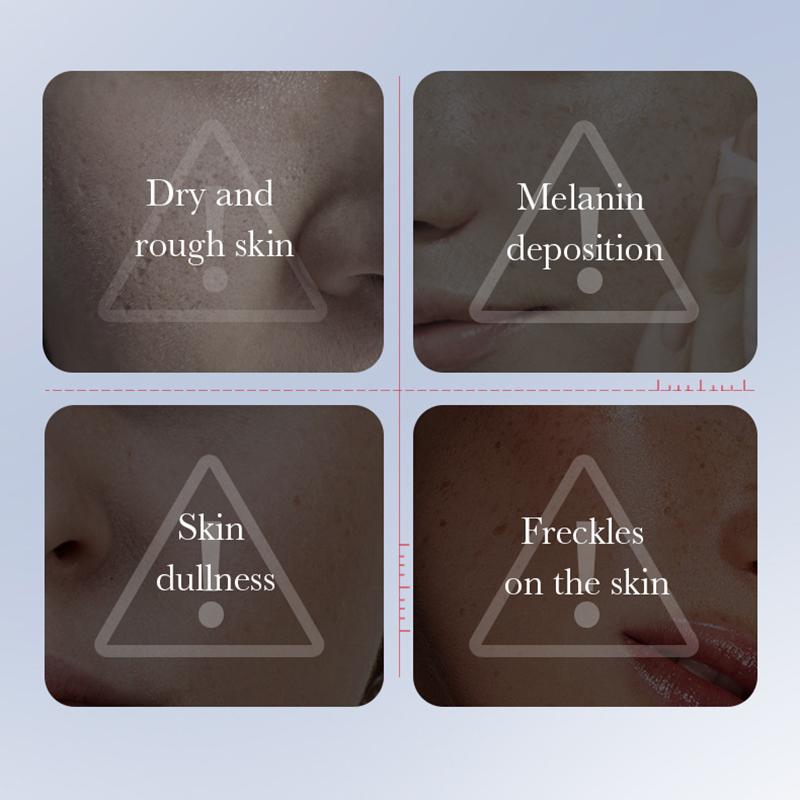 SADOER Kojic Acid Whitening and Freckle Removal Cream Moisturizing Facial essence Anti-Aging Face Serum Skin Care Products