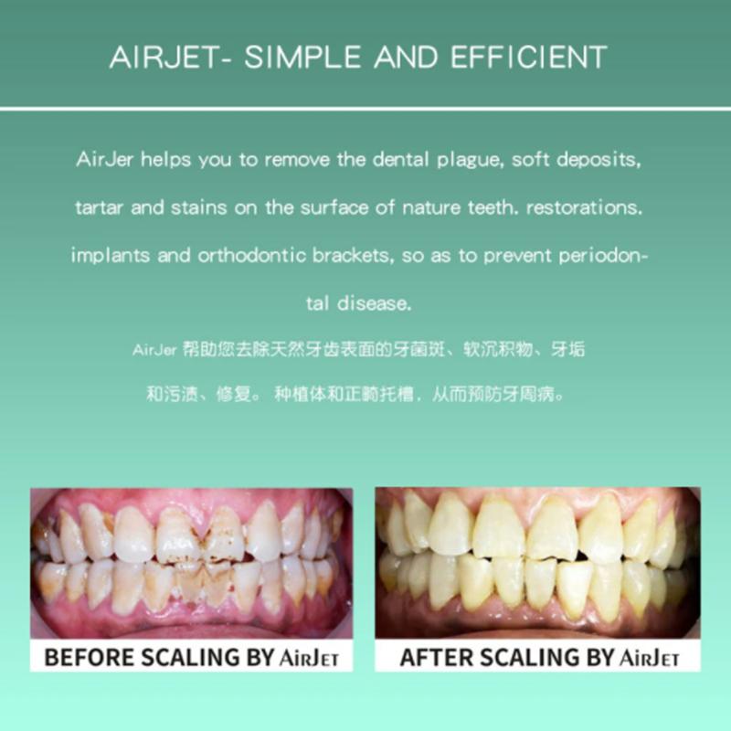 Стоматологический Air Flow Prophy Jet Airjet 1/1S Воздушный полировщик Пескоструйный аппарат Наконечник для полировки зубов Гигиенический Prophy Jet Machine