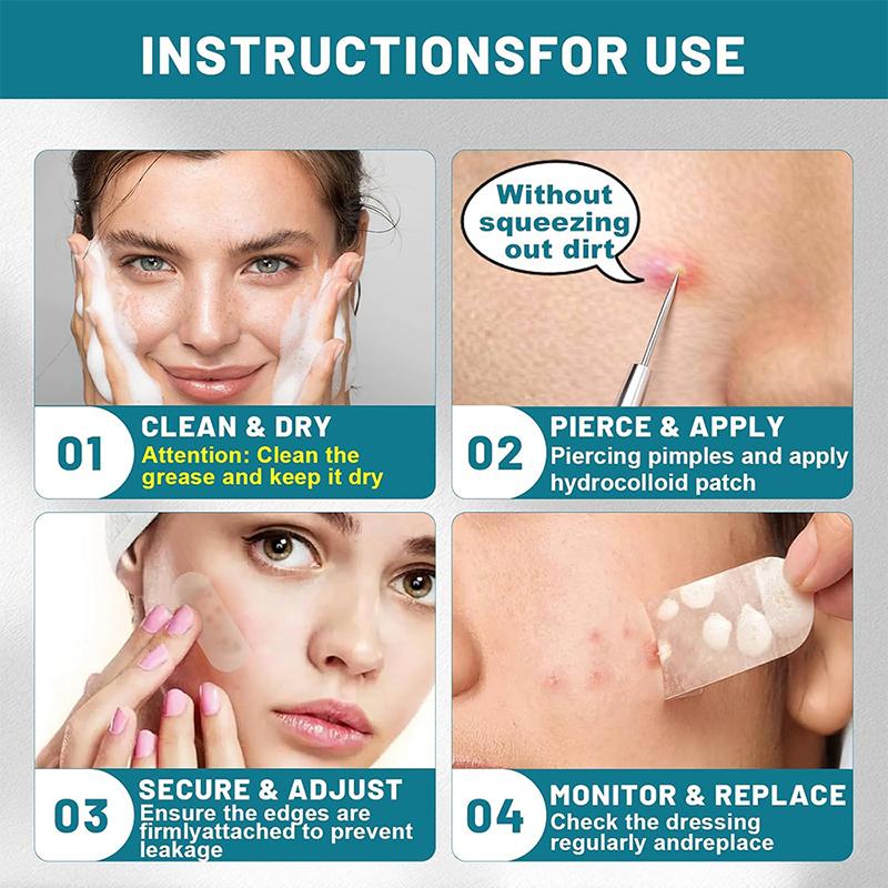 Гидроколлоидный рулон для ухода за ранами Гидроколлоидные пластыри самоклеящиеся, пластыри от пролежней, высокоабсорбирующие