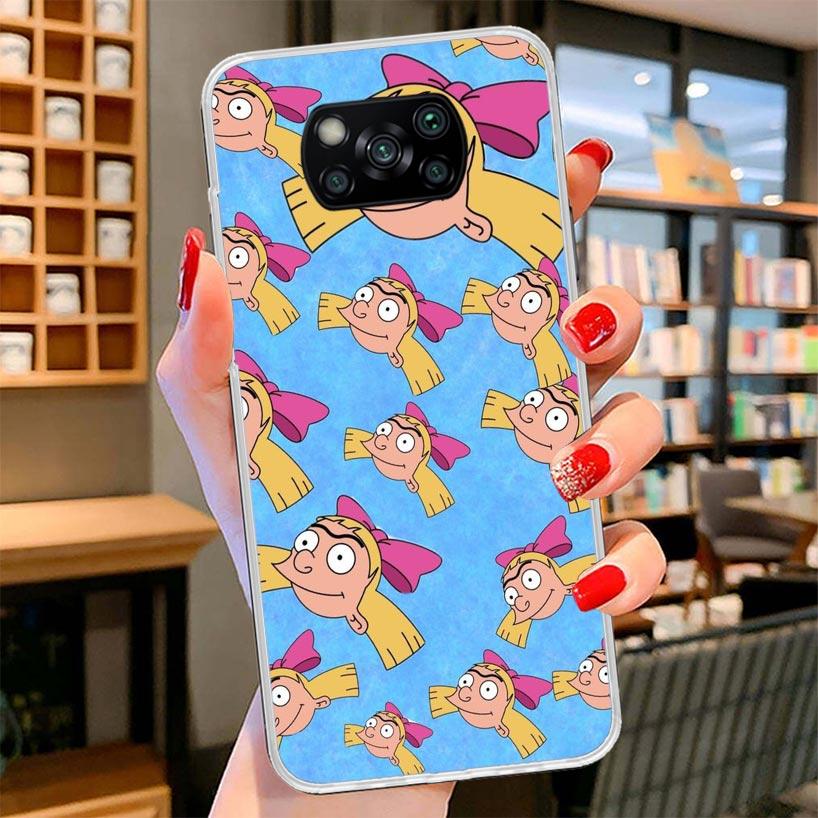 Мультяшный Хей Арнольд Фонс Чехол для телефона Для Xiaomi Poco F7 Ultra X7 X6 X5 Pro M7 Redmi 15C 15 13C 13 12C 12 10C 10 9A 9C 9T 9