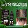 Mild Sulfate-Free Shampoo for Sensitive Scalps with Dermatitis Relief
