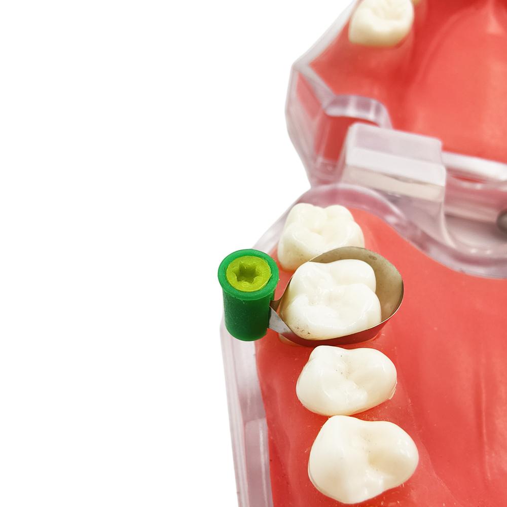 Дентальные матричные ленты Дентальная система Super Mat / Super Cap Матрицы Super Cap Адапт Универсальная система натяжения матриц