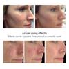 Brightening cream that brightens skin tone, tightens skin and reduces dullness