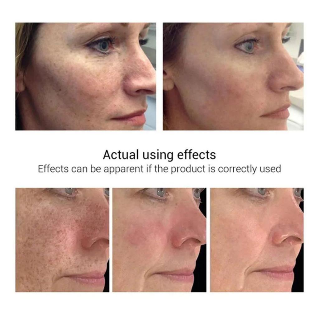 Brightening cream that brightens skin tone, tightens skin and reduces dullness