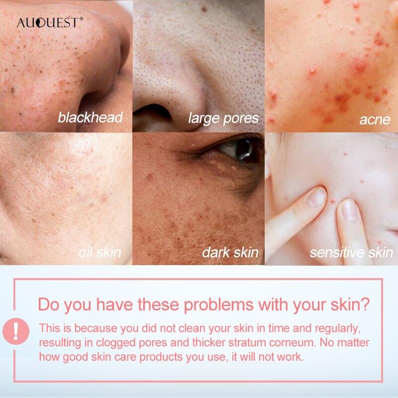 Восстанавливает жирную кожу. Розовая грязевая маска очищает поры от угрей и прыщей. Розовая грязевая маска восстанавливает жирную кожу.