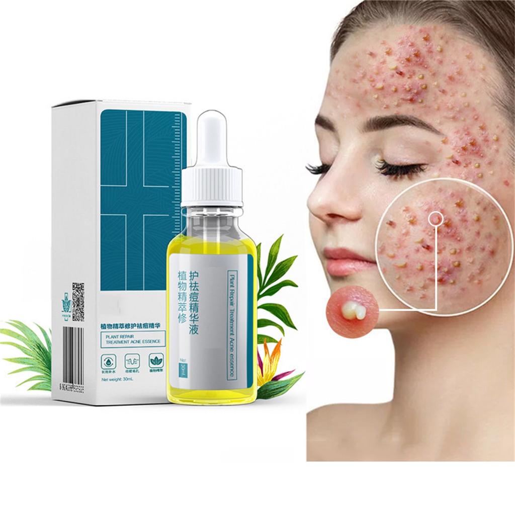 Отбеливающий крем для лица Отбеливающий крем для лица Увлажняющий осветляющий крем для кожи лица Натуральный травяной экстракт 30 мл