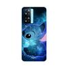 Coque de téléphone - MANIACASE - Oppo A57s 4G - Silicone TPU - Souple - Motif Stitch