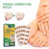 50 Pcs/Set Nail Ingrown Stickers Double-sided Adhesive Ingrown Toenail Correction Ingrown Toenail Correction Tool Elastic Patch Stickers