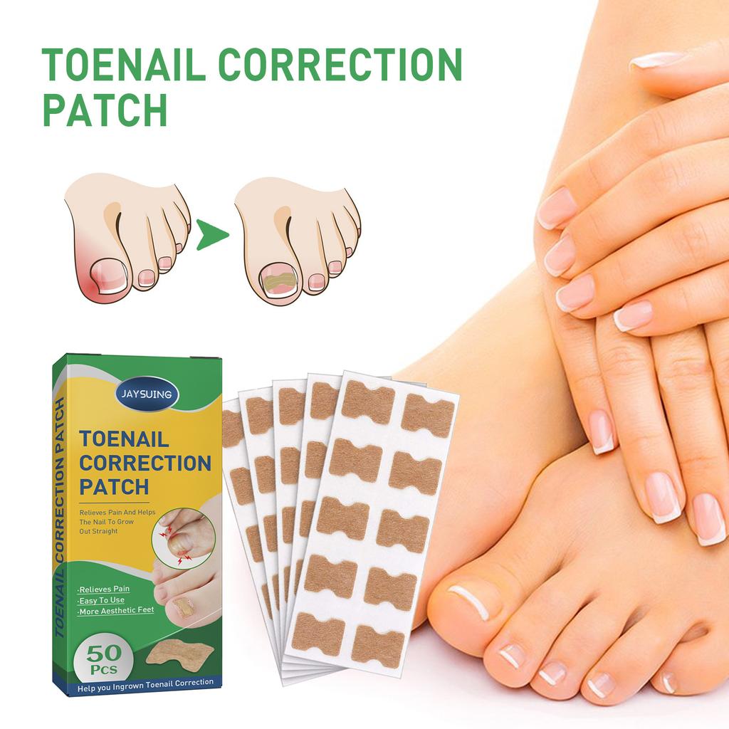 50 Pcs/Set Nail Ingrown Stickers Double-sided Adhesive Ingrown Toenail Correction Ingrown Toenail Correction Tool Elastic Patch Stickers