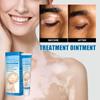 White Spot Piebald Cream Vitiligo Ointment Herbal Sweat Spot Cream Body Skin Care
