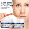 Whitening Freckle Cream Remove Melasma Cream Remove Dark Spots Anti Wrinkles Brighten Moisturizing Skin Care for Unisex