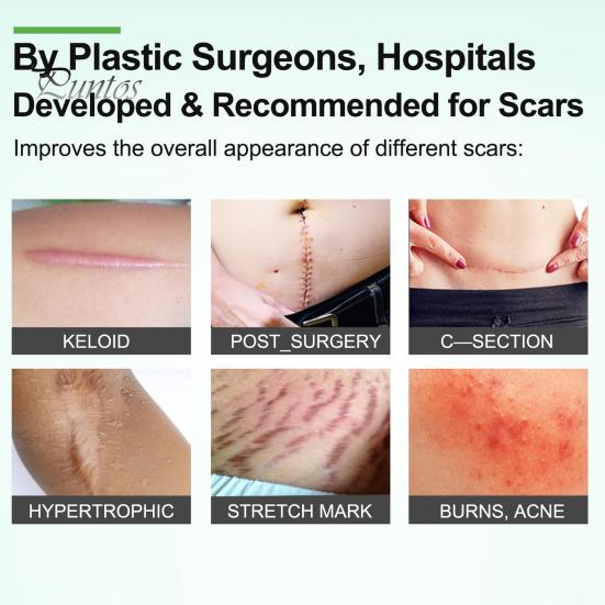 Силиконовые пластыри для рубцов, рулон ленты для рубцов, профессиональные мягкие полоски для рубцов после хирургических операций, келоидные рубцы, лечение угревой сыпи, силиконовый гелевый пластырь
