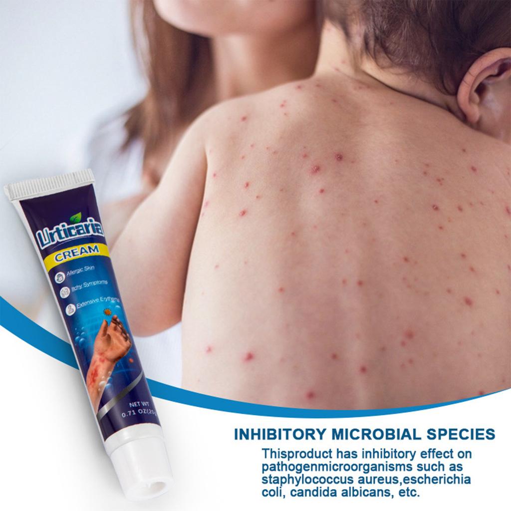 20 г местного крема от крапивницы: Эффективное средство от зуда, быстро снимает раздражение кожи, рекомендовано дерматологами