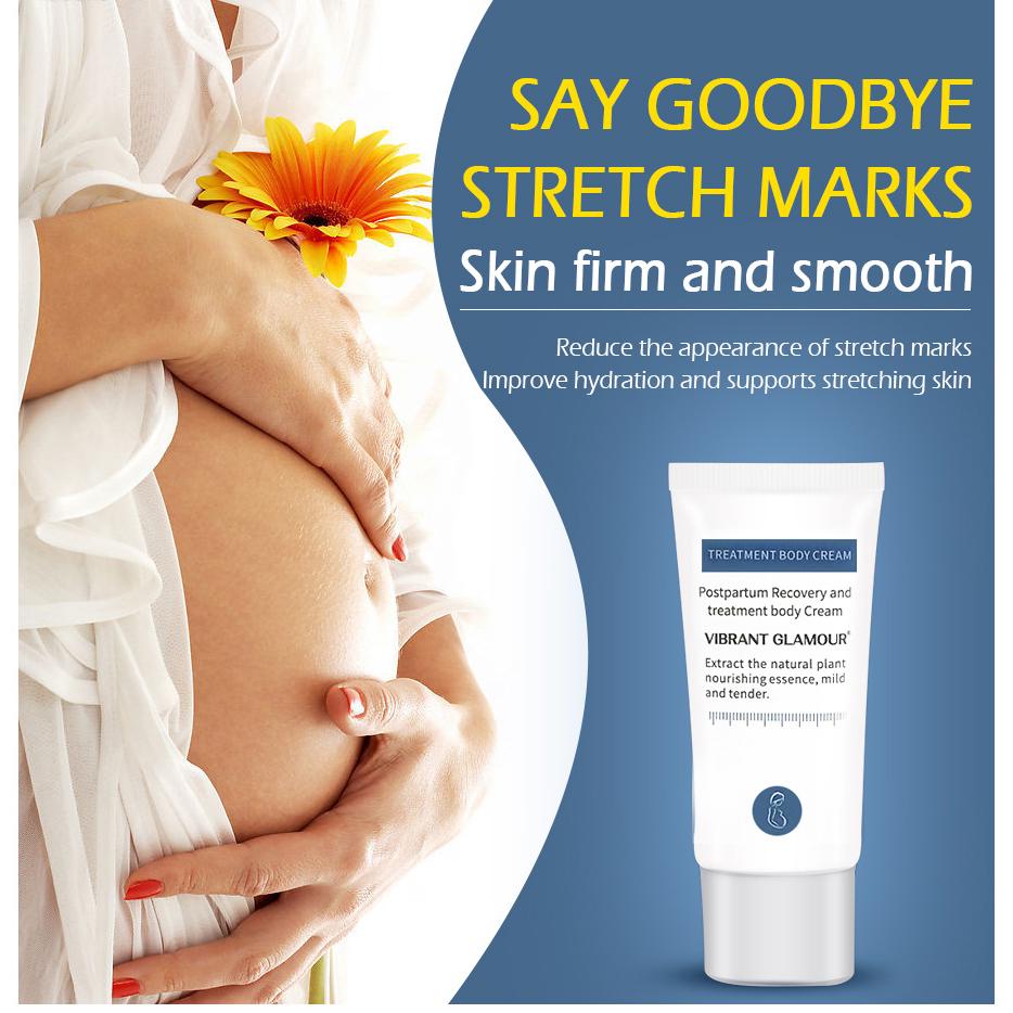 VIBRANT GLAMOUR Крем для удаления растяжек, набор кремов для ремонта тела, шрамы для беременных, линии ожирения, шрамы, антивозрастной укрепляющий уход за кожей, 2 шт.