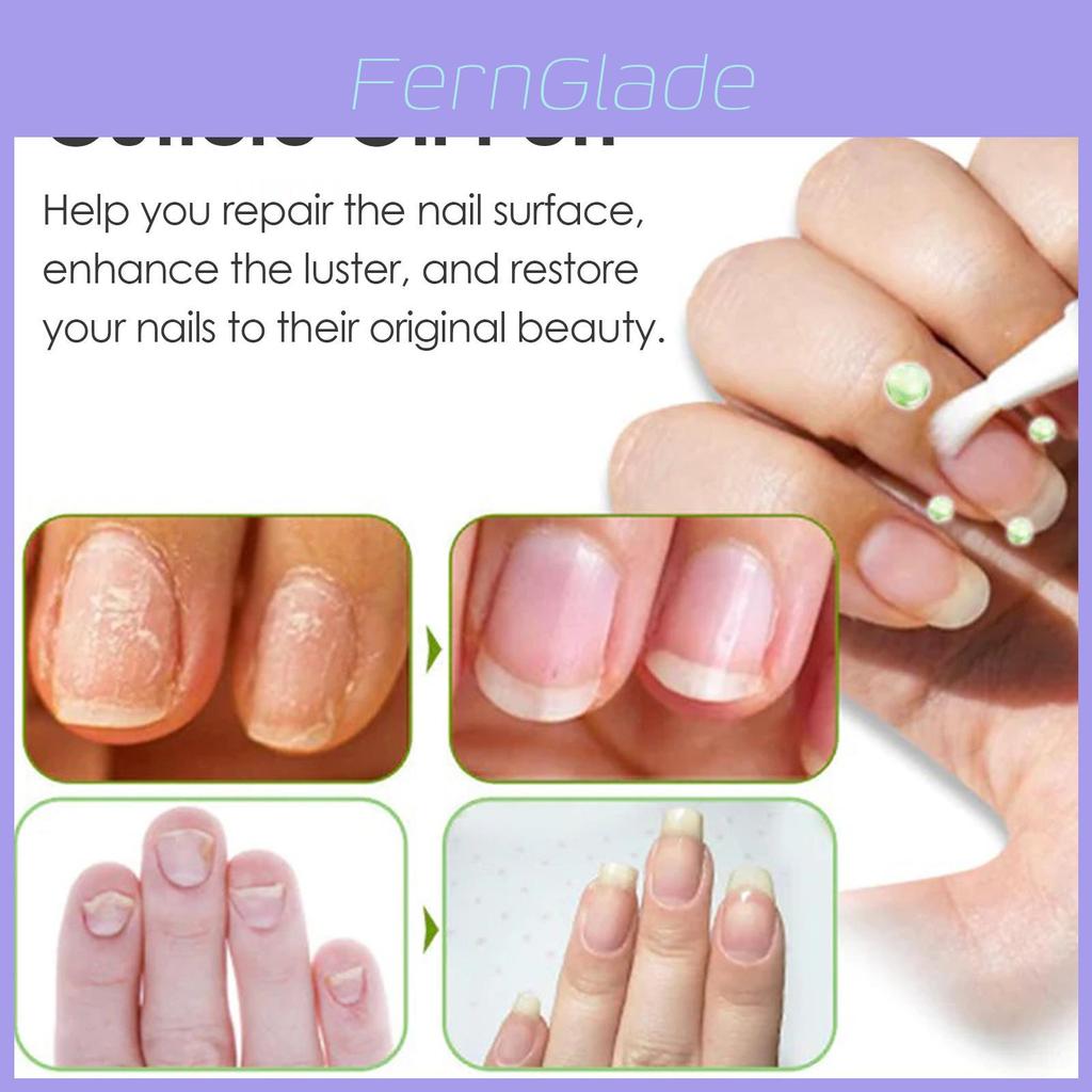 Oceaura Green Apple Nail Care Oil Deeply Nourishing Formula For Healthy Nails And Cuticles