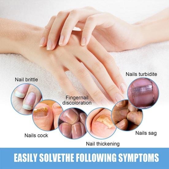 32 Pcs Nail Repair Patches Foot Patch Soft Breathable Thicken Nail Care Treatment Patch Non-irritating Toenail Remedy for Discolored Damaged Nails