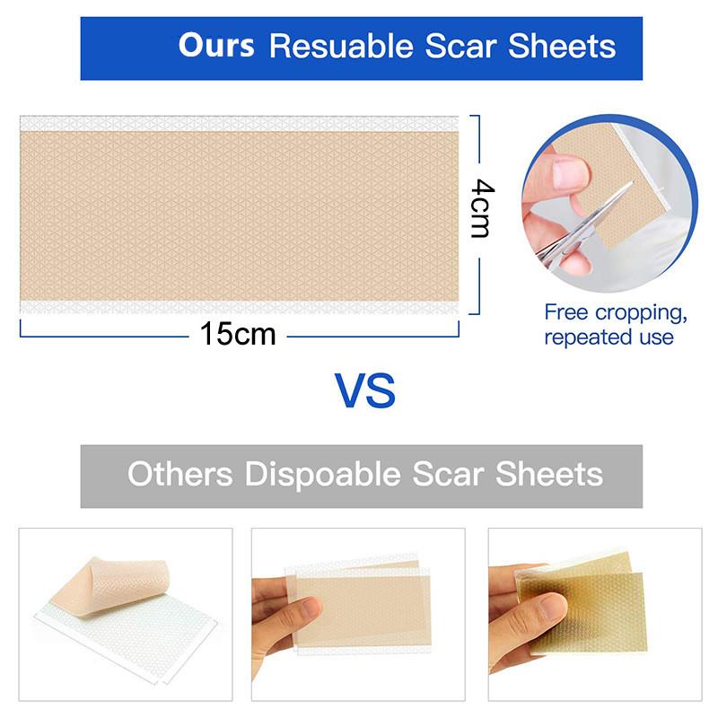 Scar Patches Remove Silicone Gel Sheet Treatment Patch Ear Correctors Burn Wounds Efficient Surgery Scar Tape Skin Repair