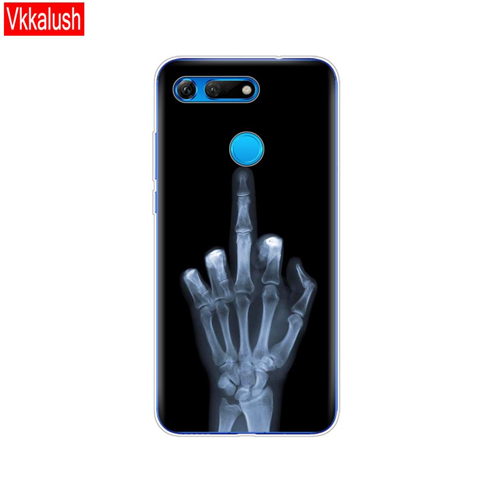 Силиконовый чехол для телефона для Huawei Honor View 20 V20, чехол из ТПУ, мягкий силиконовый чехол для Honor V20, чехол с милым животным узором