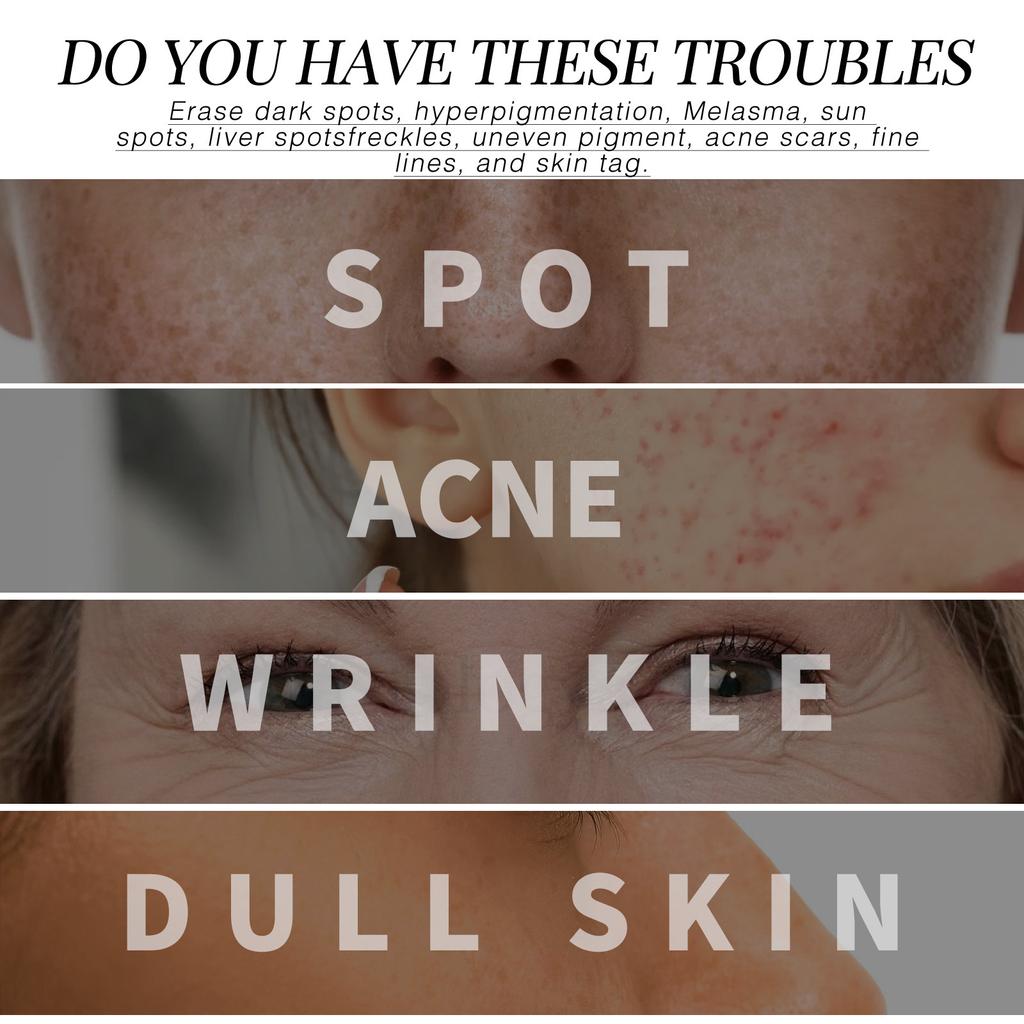 Крем EELHOE Retinol Collagen Cream Осветляет мелкие морщины Укрепляет кожу Выравнивает тон кожи Увлажняет крем для лица