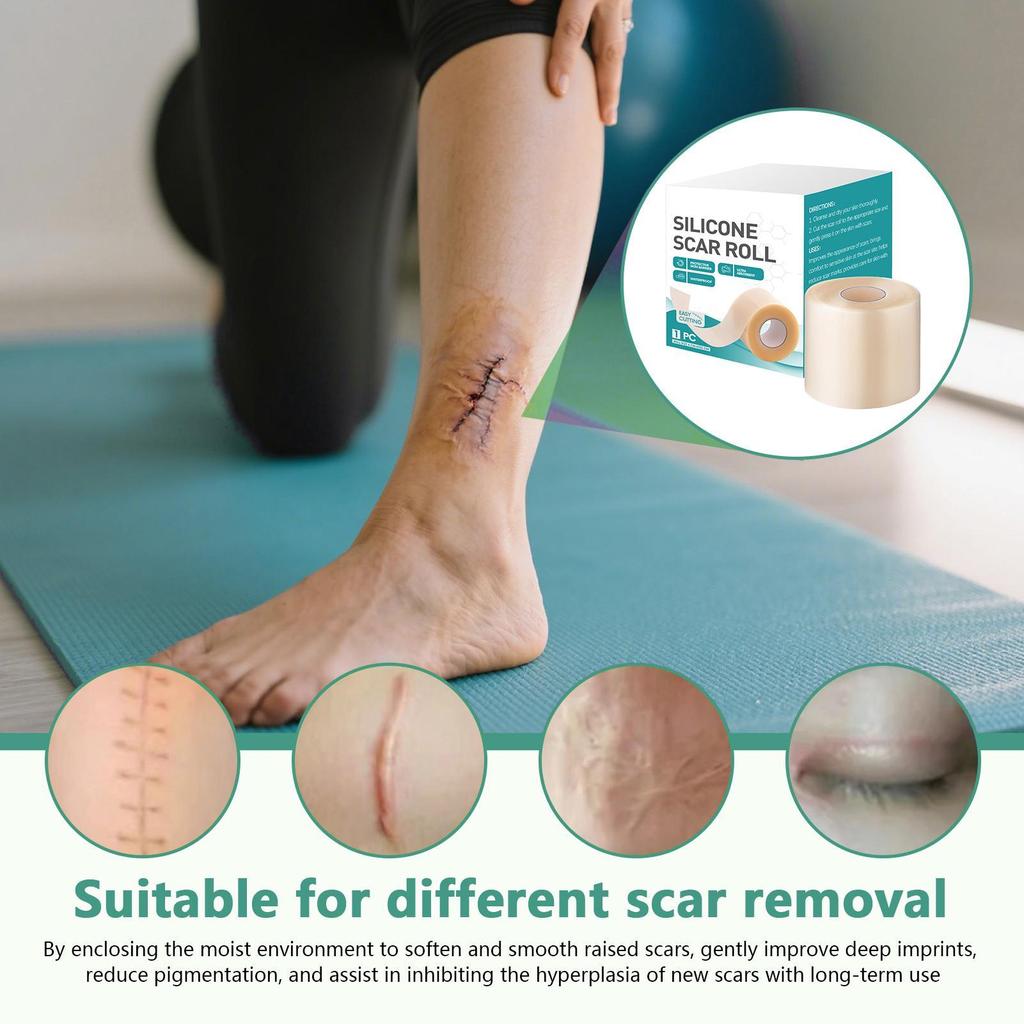Silicone Scar Sheets Reusable Face Scar Removal Patch Fast Healing Repair Strips Beauty Supplies for Adults Kids Women Burn