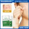 West&Month Acne Pimple Patch Stickers Acne Treatment Pimple Remover Tool Blemish Spot Facial Mask Skin Care Waterproof 36 Patches