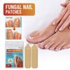 Полоски для ухода за пальцами ног Ремонт косточки на ноге Гнилой ноготь Мягкий ноготь Вросший ноготь Полоски для ухода за ногтями
