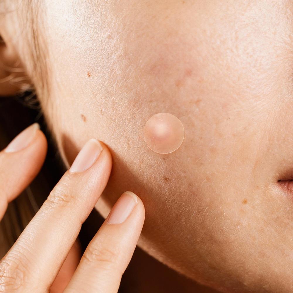 Hydrocolloid Breathable Pimple Patches - 100 Count, Transparent & Invisible for Makeup