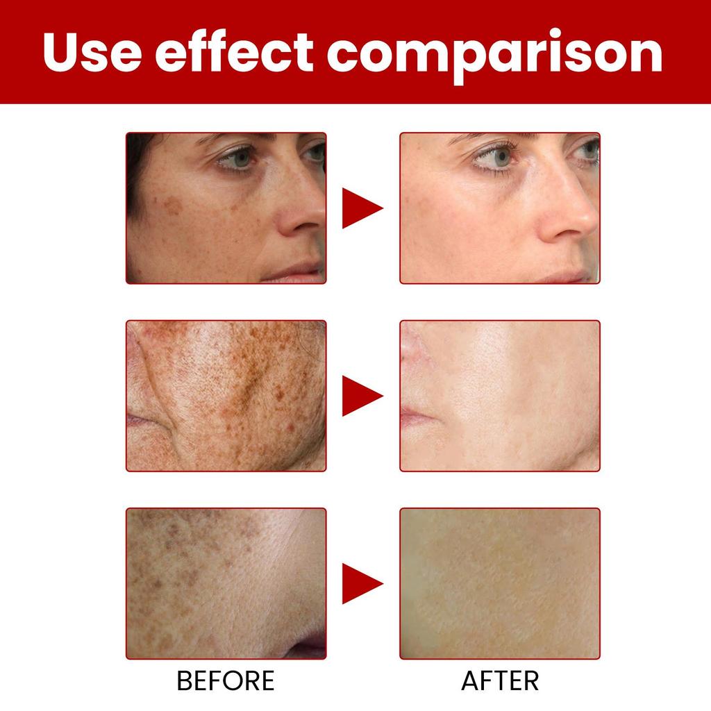 OUHOE Крем для ухода за лицом, осветляет пигментные пятна, увлажняет и питает, восстанавливает кожу, придает сияние и отбеливает. Подходит для использования на лице, 20 г.