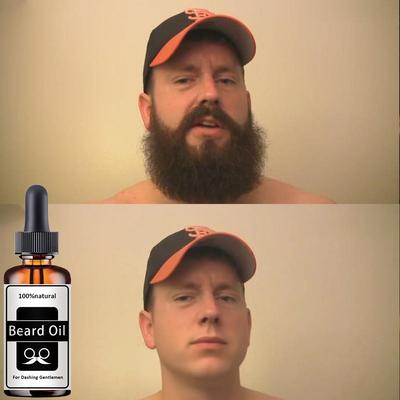 Мощное масло для роста бороды для мужчин, эфирные масла для роста волос, эссенция против алопеции, другие средства от выпадения волос
