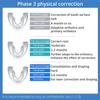 Orthodontic Straight Teeth Retainer Food-grade Medical Grade Silicone