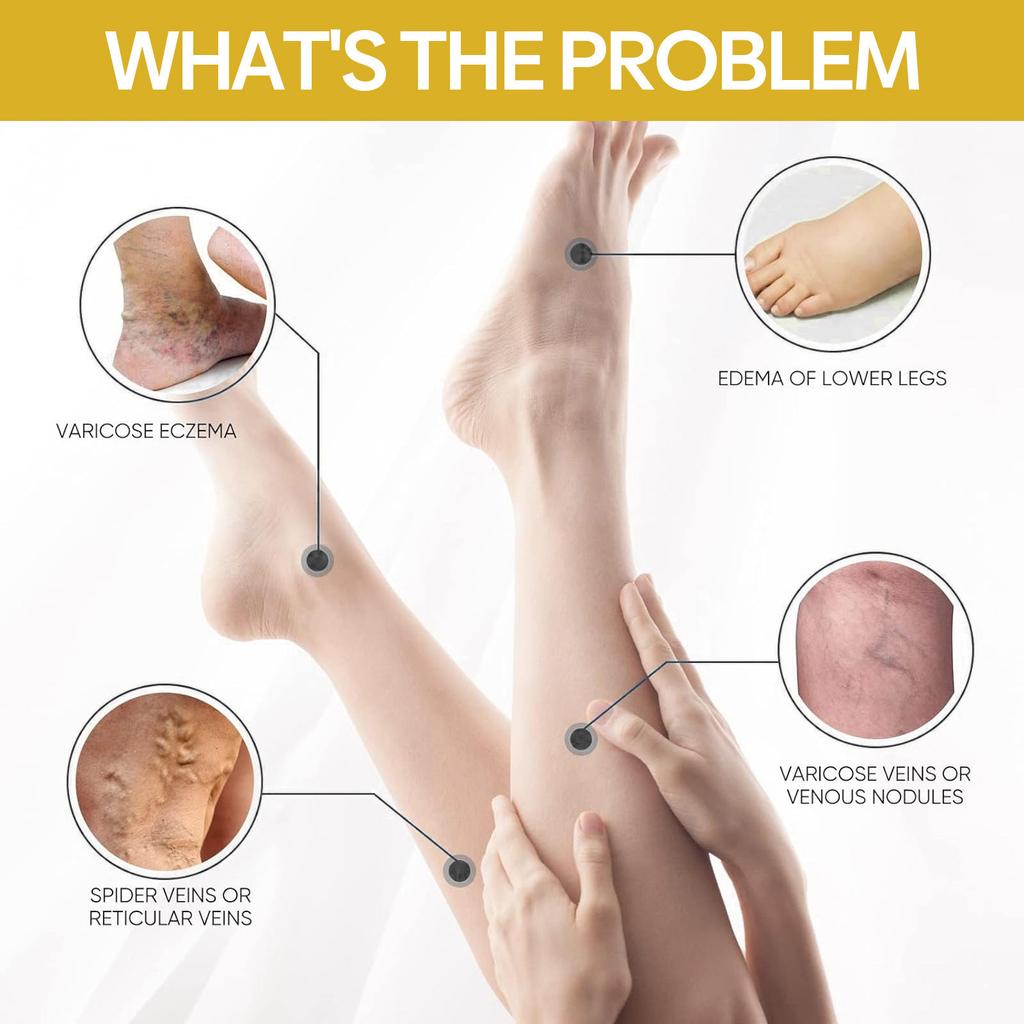 Venoheal Varicose Vein Ease Paste, Varicose Veins Paste, Varicose And Spider Veins Ease For Legs, Improve Blood Circulatio